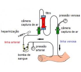 Kit de linha arteriovenosa