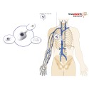Catéter Venoso Totalmente Implantável Micro polysite Catéter Venoso Totalmente Implantável Micro polysite