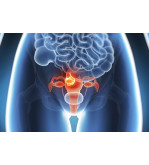 Dispositivo implantável de reconstrução para incontinência urinária feminina,