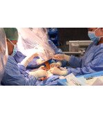 SERVIÇO DE NEUROMONITORIZAÇÃO INTRAOPERATÓRIA COM NEUROFISIOLOGISTA