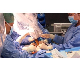 SERVIÇO DE NEUROMONITORIZAÇÃO INTRAOPERATÓRIA COM NEUROFISIOLOGISTA