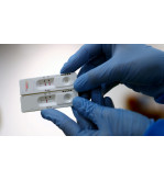 Teste Rápido de Anticorpo do H. Pylori