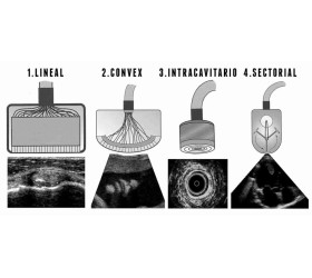Reparamos diversos tipos de sondas para ultrassom