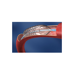 LINHA DE STENTS