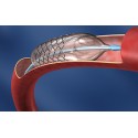 LINHA DE STENTS