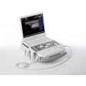 Ultrassom portátil Siemens Acuson P300 Ultrassom portátil Siemens Acuson P300