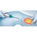 Sistema Smith & Nephew Trivex Próxima Geração para Remoção de Varizes