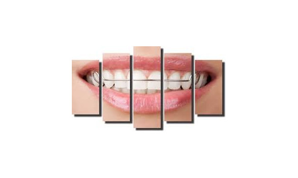 Linha acessorios para Odontologia